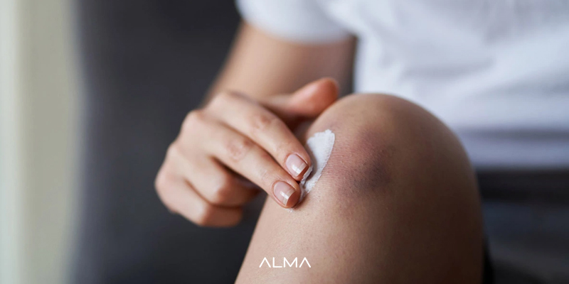 ترمیم دیرهنگام زخمها