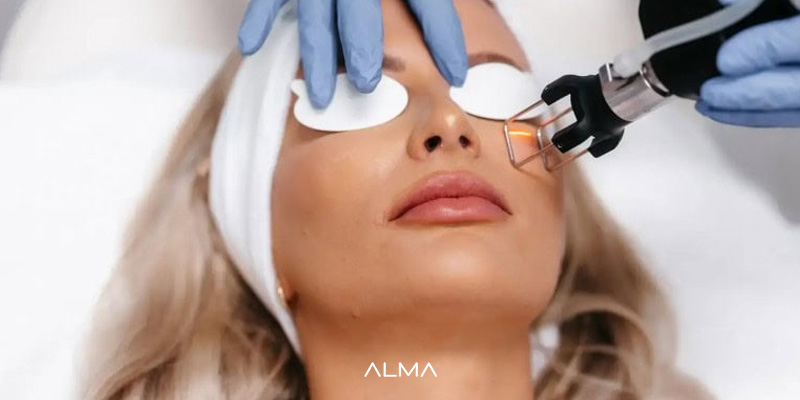 لیزر فرکشنال