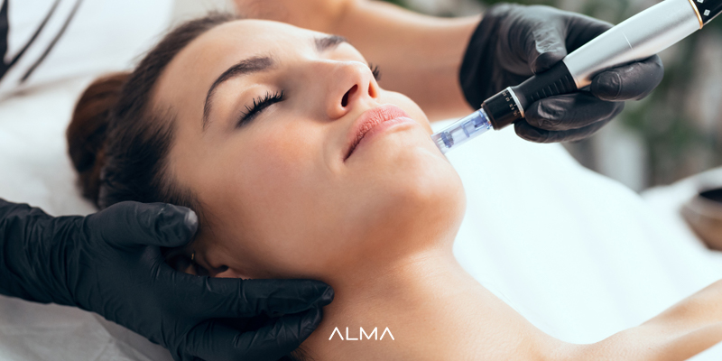 میکرونیدلینگ