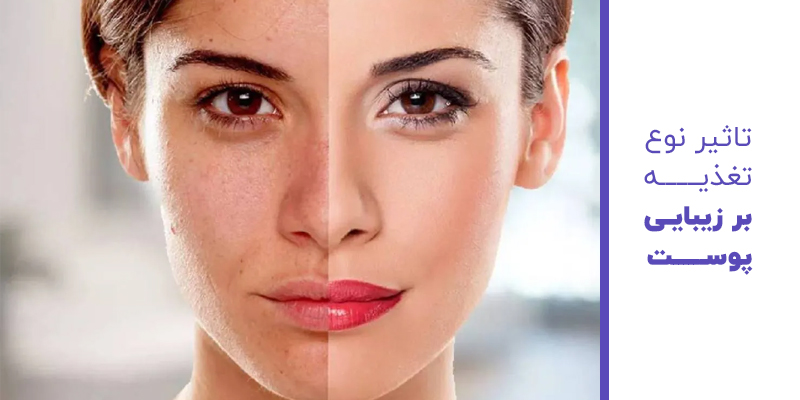 تاثیر نوع تغذیه بر زیبایی پوست
