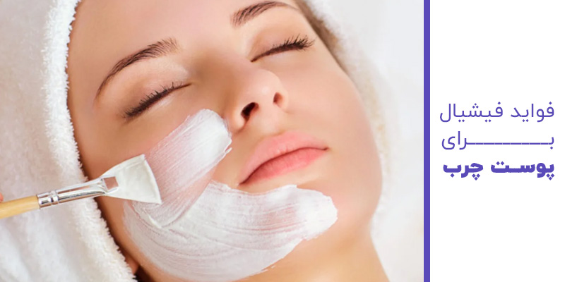 فواید فیشیال برای پوست چرب