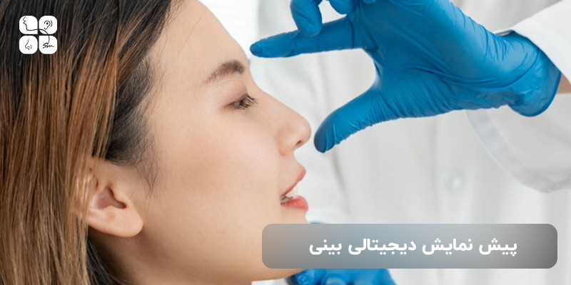 پیش نمایش دیجیتالی بینی