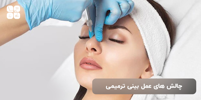 چالش های عمل بینی